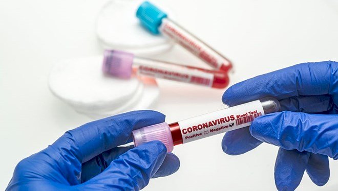 30 Mart 2021 corona virüs tablosu: 155 can kaybı, 37 bin 303 yeni vaka